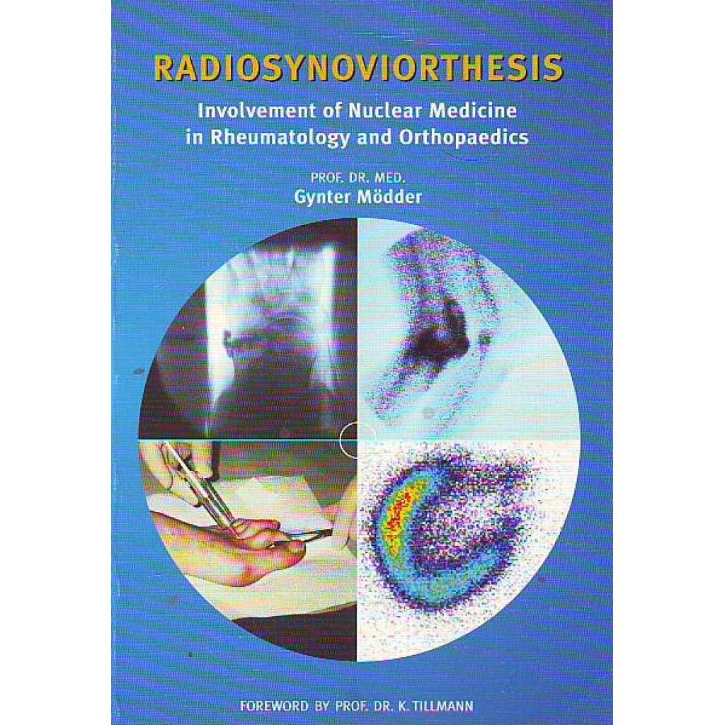 Radiosynoviorthesis. Involvement of Nuclear Medicine in Rheumatology and Orthopaedics (lékařství, revmatologie, ortopedie)
